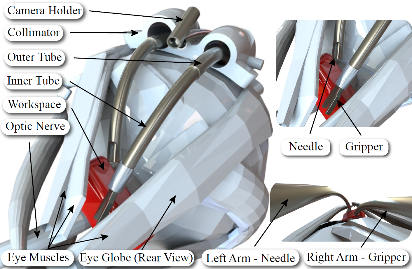 [2020] Optic Nerve Sheath Fenestration with a MultiArm Continuum Robot